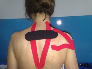 Medical Taping_Αυχένας