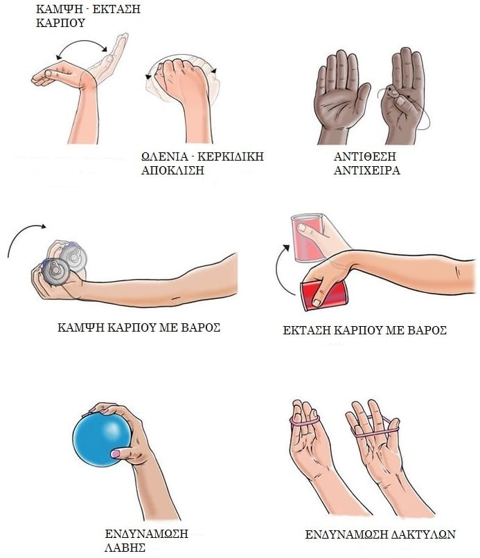 Κάταγμα σκαφοειδούς οστού άνω άκρου 